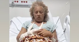 A atriz se manifestou sobre a prisão do agressor