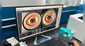 O Pará foi o primeiro Estado da Região Norte onde o Sinab foi implantado, com mais cinco Estados.