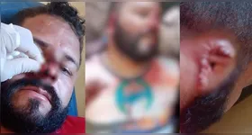 Homem atacado por pitbull teve ferimentos em várias partes do corpo, incluindo mãos, pernas, orelha e rosto.