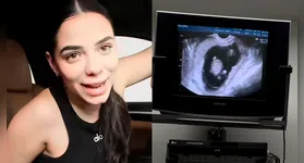 Key Alves mostra ultrassom e diz que ganhou 6kg em quatro meses de gestação