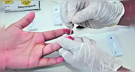 A Região Norte concentra 72% dos casos de hepatite D no Brasil, com maior incidência em áreas remotas da Amazônia Legal.