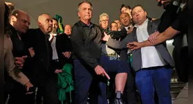 Bolsonaro exibe a tornozeleira eletrônica