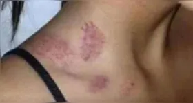 Imagem ilustrativa da notícia Mulher em Paragominas diz ter sido atacada por 'lobisomem'
