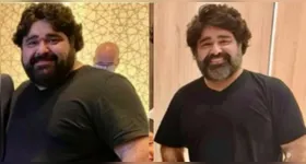 Cantor compartilhou mudança de visual no Instagram