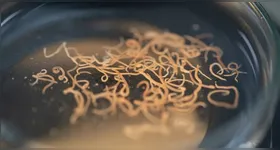 Verminoses são doenças causadas por parasitas que sobrevivem a partir de um organismo hospedeiro, como os seres humanos.