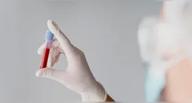 Proteínas presentes no soro de pessoas com menos de 30 anos só promovem o rejuvenescimento de células da pele humana quando interagem com células da medula óssea