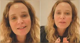 Fernanda Rodrigues havia anunciado recentemente a volta de seu câncer de pele.