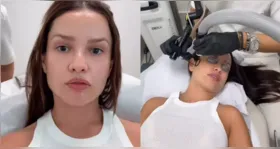 Diferentemente do que muitos podem imaginar, o procedimento não envolve a aplicação direta do esperma do peixe no rosto.