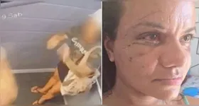 Mais de 2 mil pessoas se mobilizam para ajudar Juliana Garcia após agressão brutal.