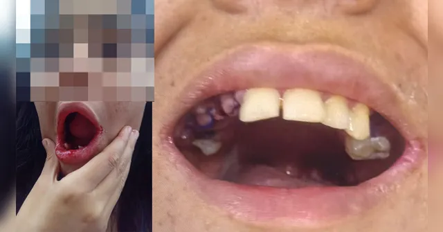 Imagem ilustrativa da notícia Helder afasta médico que extraiu 17 dentes de jovem autista