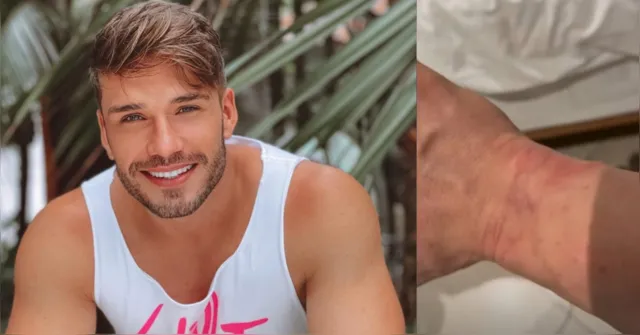 Imagem ilustrativa da notícia Campeão de “A Fazenda” aparece ferido e diz ter sido preso em Dubai
