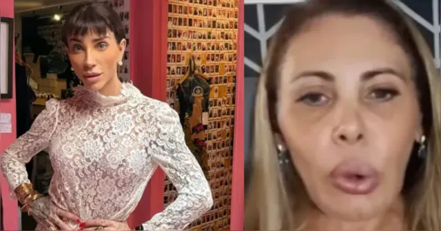 Imagem ilustrativa da notícia Essas são as cirurgias bizarras de famosos que viraram polêmica