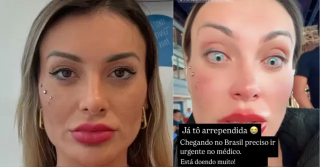 Imagem ilustrativa da notícia Andressa Urach se arrepende de cirurgia para clarear olhos: 'Muita dor'