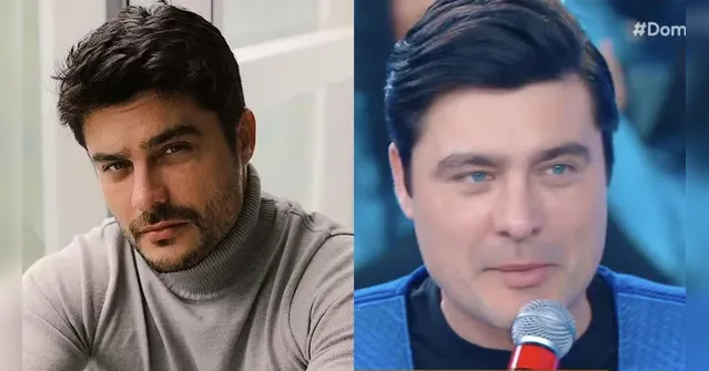 Imagem ilustrativa da notícia Ex-galã da Globo se revolta após críticas sobre sua harmonização facial