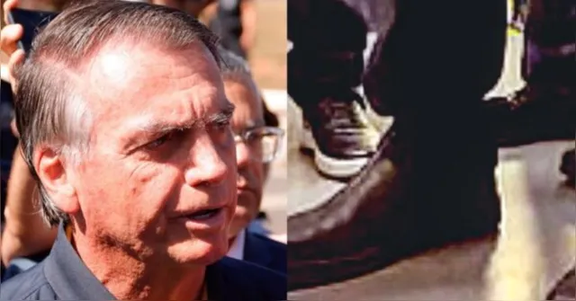 Imagem ilustrativa da notícia Como funciona a tornozeleira eletrônica usada por Bolsonaro