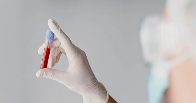 Imagem ilustrativa da notícia Cientistas descobrem como rejuvenescer a pele usando sangue jovem