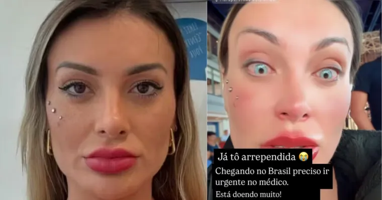 Imagem ilustrativa da notícia Andressa Urach se arrepende de cirurgia para clarear olhos: 'Muita dor'