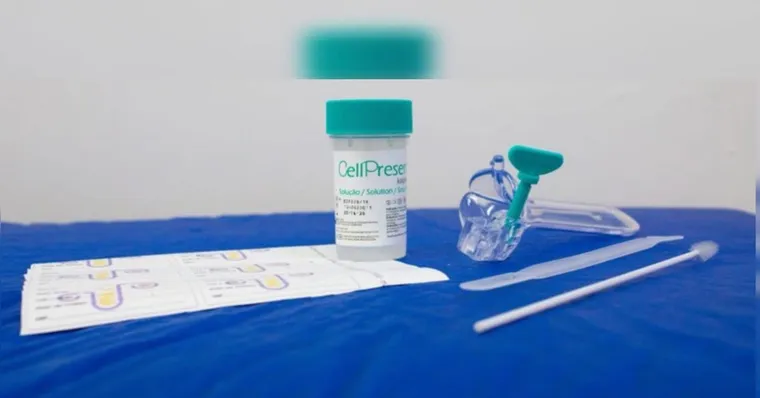 Imagem ilustrativa da notícia Exame de DNA começa a substituir papanicolau no SUS; entenda