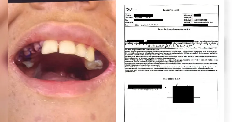 Imagem ilustrativa da notícia Extração de dentes de jovem autista foi autorizada, aponta documento
