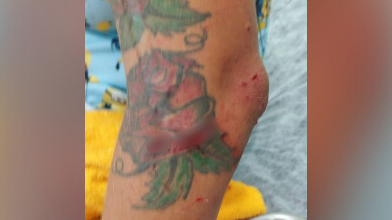 A mulher foi levada para o hospital depois dos ferimentos