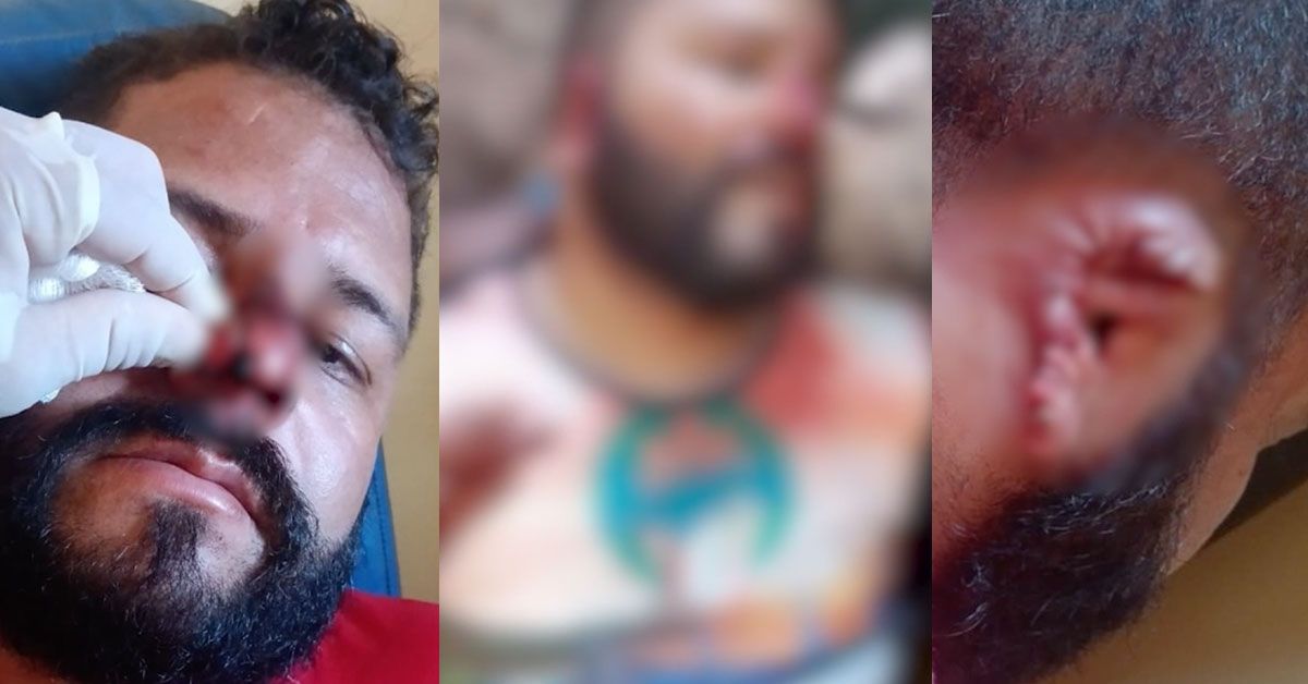 Imagem ilustrativa da notícia: VÍDEO: Homem fica gravemente ferido após ser atacado por pitbull no Pará