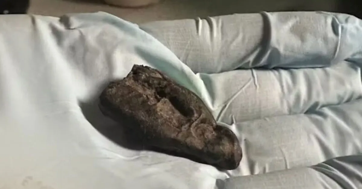 Alcatrão de bétula pré-histórico observado em estudo