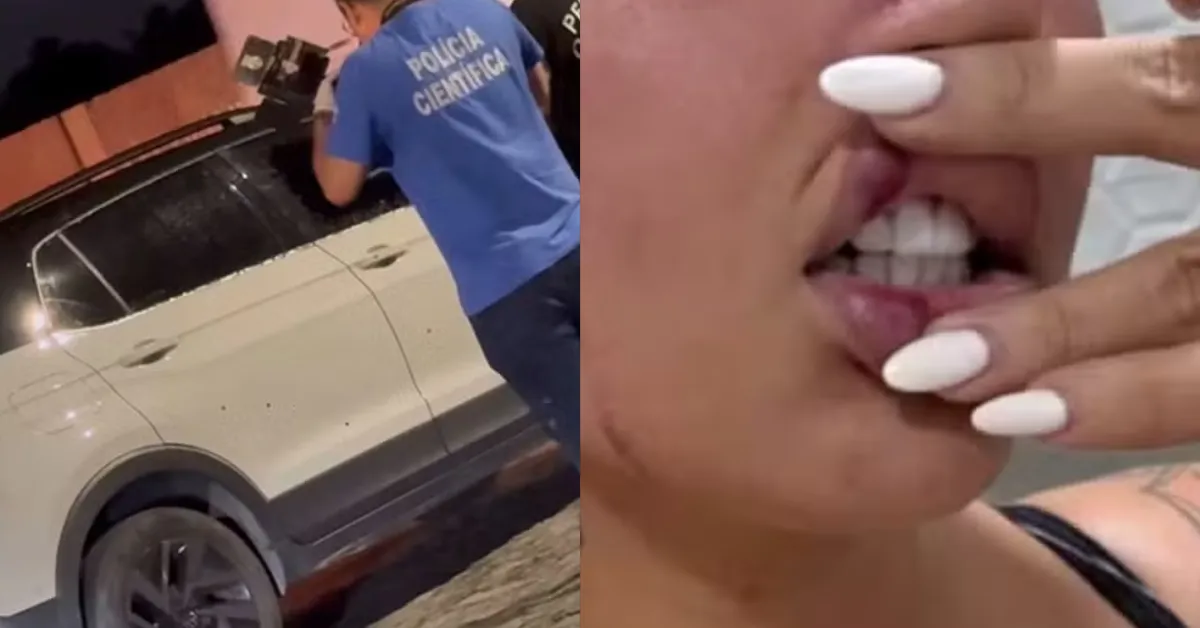 A influenciadora "Ruivinha" foi atingida na mão.