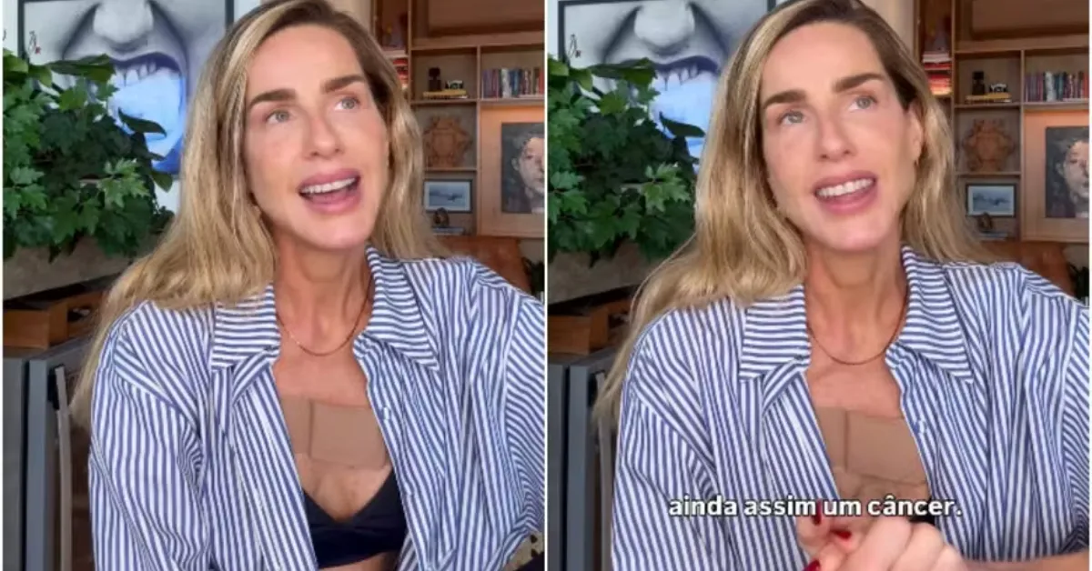 Mariana Weickert revela diagnóstico de câncer de pele