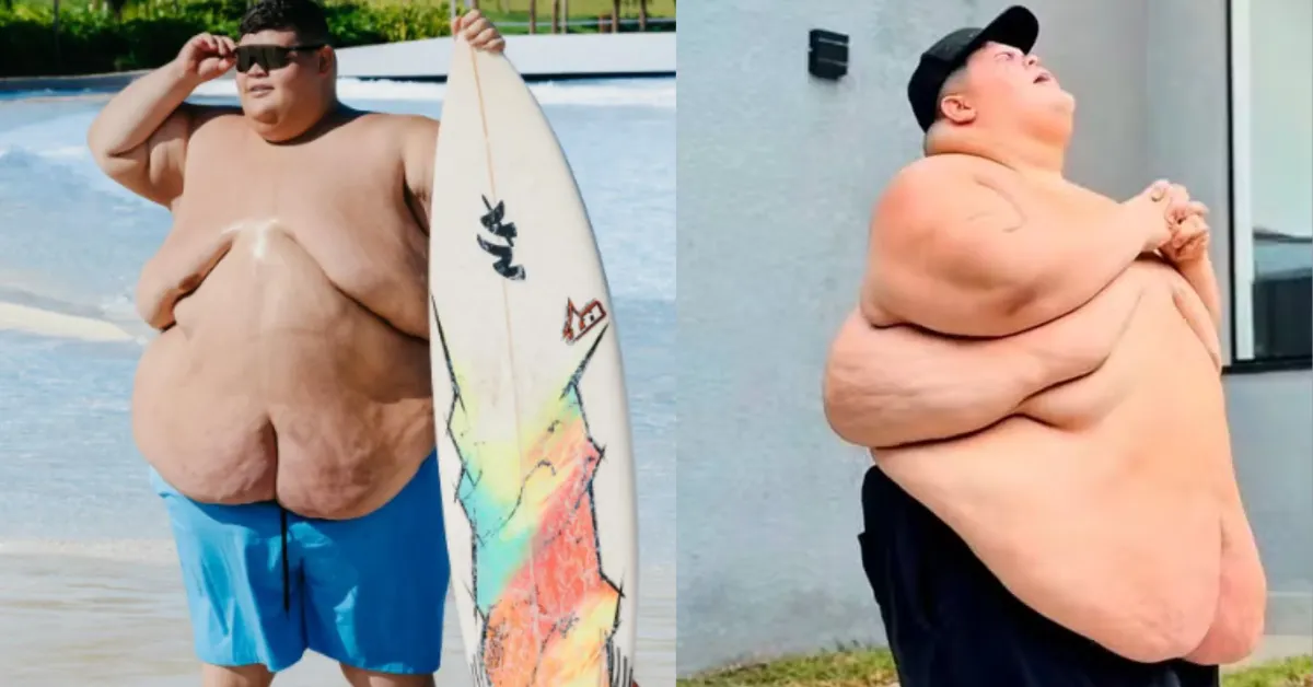 Gordão da XJ compartilhou um novo antes e depois mostrando os avanços na perda de peso.