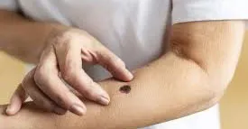 Atendimento gratuito alerta para a importância de observar sinais na pele e buscar prevenção precoce.