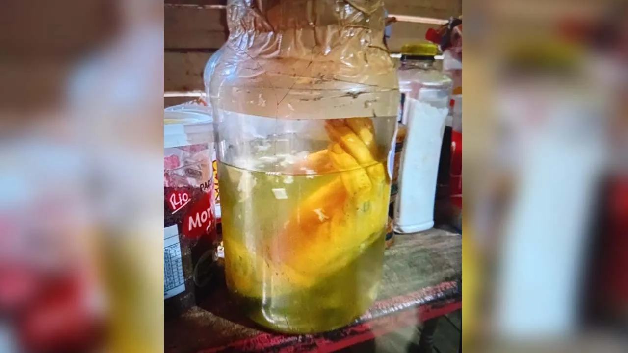 Mão em conserva; membro estava em recipiente