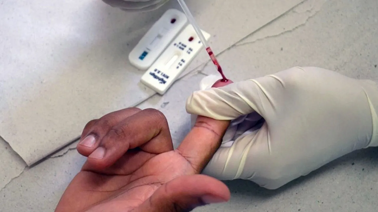 Testes rápidos de HIV são ofertados gratuitamente pelo SUS