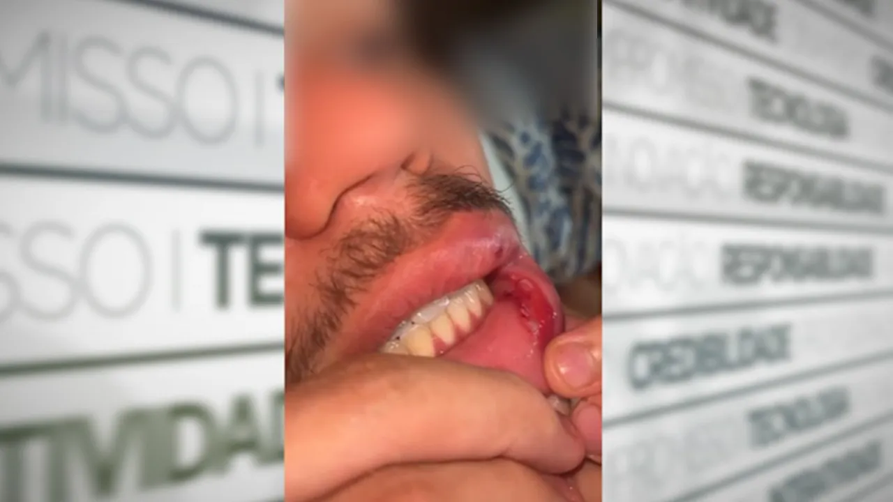 A vítima levou um soco na boca.