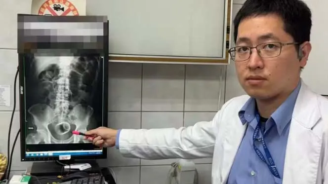 Médico mostra raio-X que mostra a xícara dentro do paciente