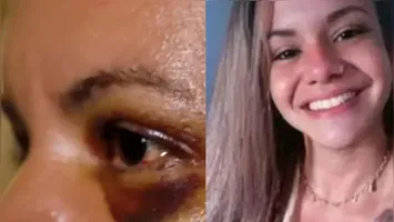Juliana Garcia foi agredida com 61 socos pelo namorado