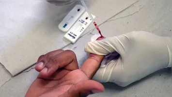 Testes rápidos de HIV são ofertados gratuitamente pelo SUS