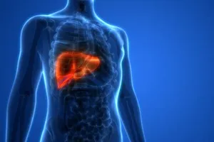 A doença ocorre quando há acúmulo excessivo de gordura nas células hepáticas, geralmente desencadeado por obesidade