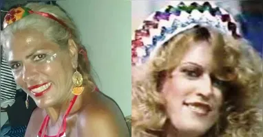 Lia Hollywood sofreu ferimentos gravíssimos e precisou ter um dos braços amputado.