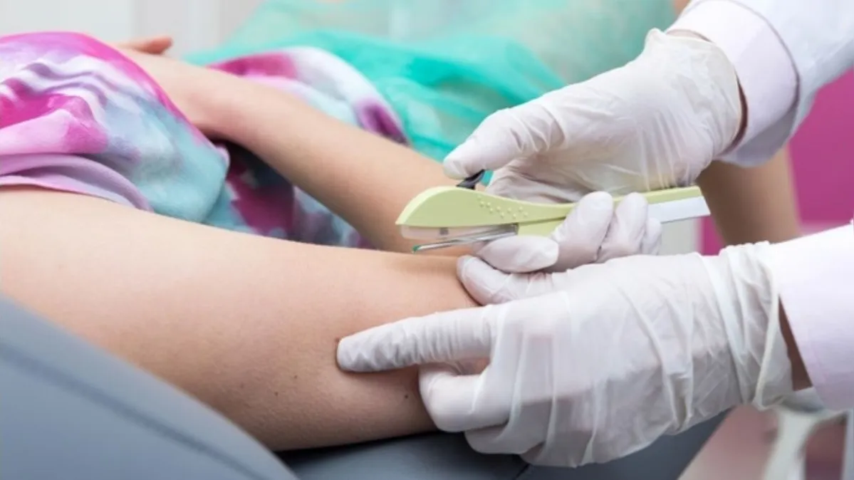 Imagem ilustrativa da notícia Planos de saúde passam a cobrir Implanon a partir de hoje