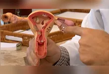 Imagem ilustrativa da notícia Menopausa precoce: causas, diagnóstico e impactos