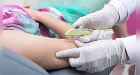 A partir desta segunda-feira (1º/9), o implante contraceptivo hormonal Implanon passa a ser de cobertura obrigatória pelos planos de saúde para pessoas entre 18 e 49 anos.