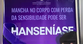 A ação tem como foco o diagnóstico precoce e o tratamento oportuno da hanseníase.