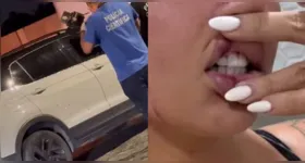 A influenciadora "Ruivinha" foi atingida na mão.