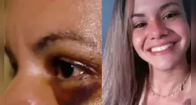 Juliana Garcia foi agredida com 61 socos pelo namorado