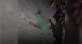 Polícia Civil já teria identificado o suspeito e segue na busca.