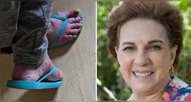 Rejane Schumann, ex-atriz da Globo, estava vivendo em situação de abandono.