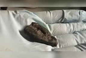 Alcatrão de bétula pré-histórico observado em estudo