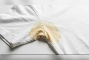 Trate pequenos sinais de amarelado logo no início, quando a remoção é mais simples e eficaz.