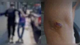 Após a denúncia, a Polícia Civil realizou diligências e localizou o suspeito, que foi detido e autuado pelo crime de estupro.