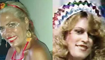 Imagem ilustrativa da imagem Ex-chacrete morre após ser atacada por pitbull do filho